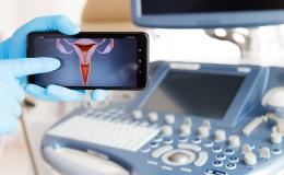 Rysunek macicy wyświetlony na telefonie, w tle aparat do USG